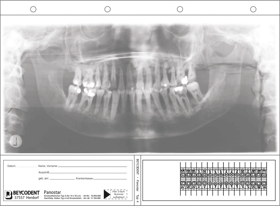 Panostar Typ 4 - Panorama-Röntgenfilm-Kartei - Nachfüllungen